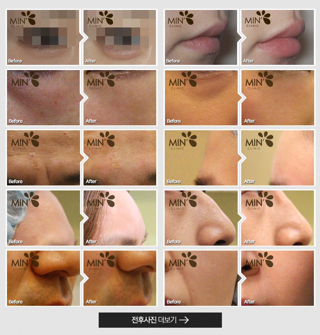 �ü�����