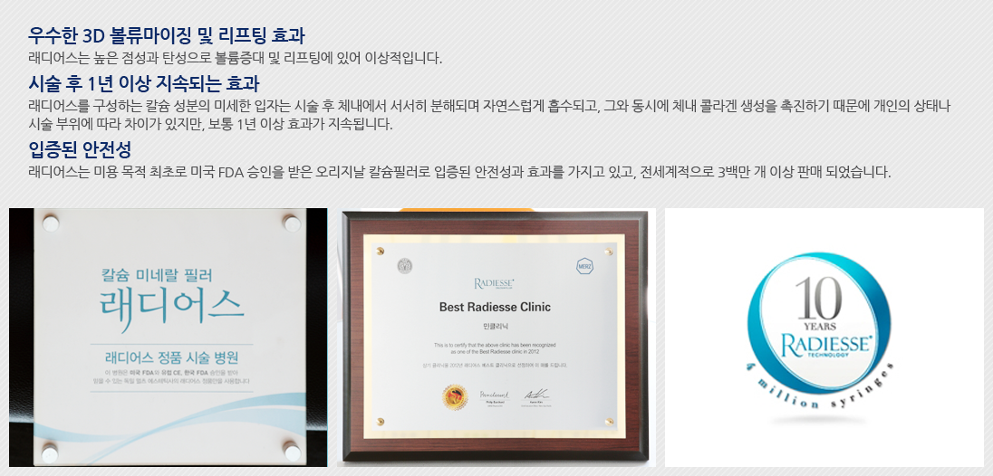 ���� Ư¡