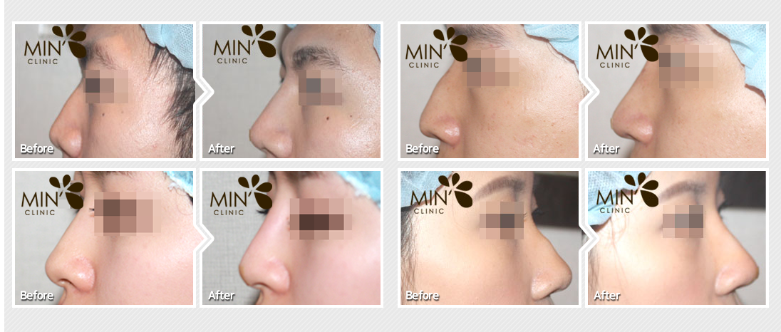 �ü�����