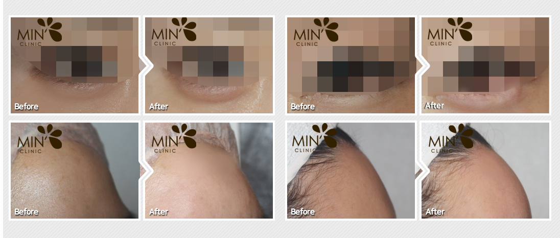 �ü�����