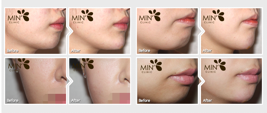 �ü�����